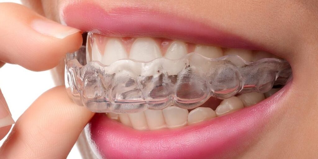 Invisalign 1920x600 1 1200x600 1 Orthodontie : tout ce que vous devez savoir sur les appareils dentaires modernes